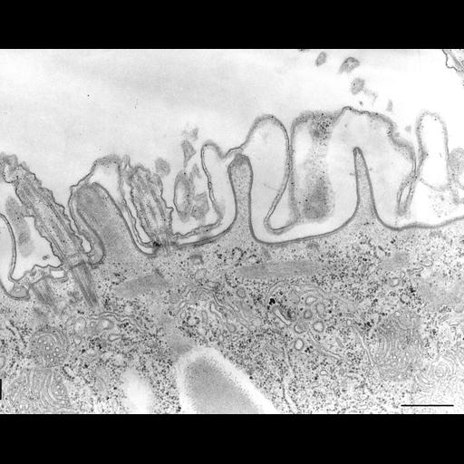  NCBI Organism:Paramecium caudatum; Cell Types:cell by organism, eukaryotic cell, , ; Cell Components:coated pit, , pellicle, cortical cytoskeleton, early endosome; Biological process:cortical cytoskeleton organization, endocytosis;