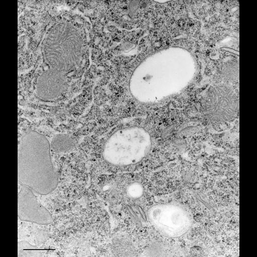  NCBI Organism:Paramecium caudatum; Cell Types:cell by organism, eukaryotic cell, , ; Cell Components:cytoplasm, mitochondrion, lysosome, peroxisome, vesicle membrane; Biological process:cytoplasm organization