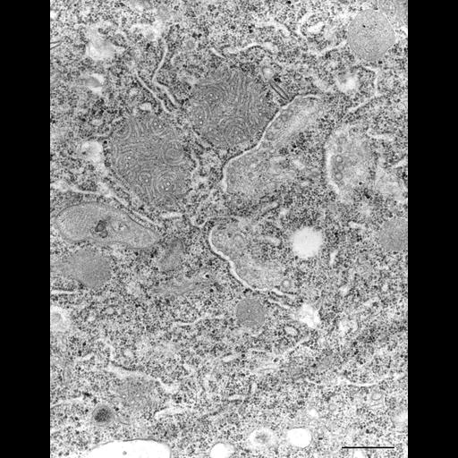  NCBI Organism:Paramecium caudatum; Cell Types:cell by organism, eukaryotic cell, , ; Cell Components:Golgi apparatus, Golgi trans cisterna, coated vesicle, cytoplasm; Biological process:Golgi organization, cytoplasm organization;