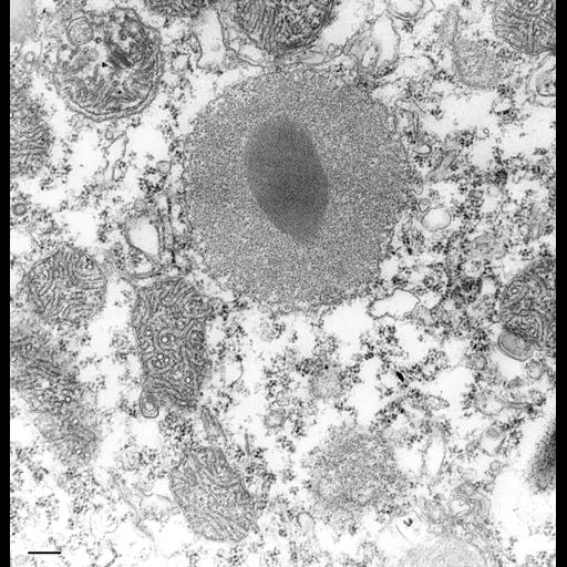  NCBI Organism:Paramecium caudatum; Cell Types:cell by organism, eukaryotic cell, , ; Cell Components:trichocyst, autophagic vacuole; Biological process:organelle assembly, autolysis;