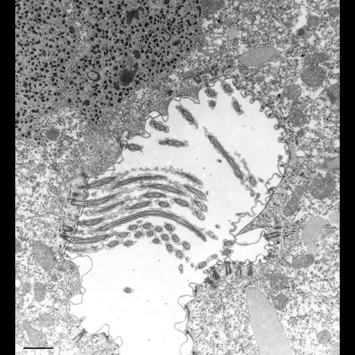  NCBI Organism:Paramecium caudatum; Cell Types:cell by organism, eukaryotic cell, , ; Cell Components:oral apparatus Biological process:oral apparatus organization