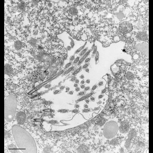  NCBI Organism:Paramecium caudatum; Cell Types:cell by organism, eukaryotic cell, , ; Cell Components:oral apparatus Biological process:oral apparatus organization