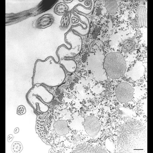  NCBI Organism:Paramecium caudatum; Cell Types:cell by organism, eukaryotic cell, , ; Cell Components:oral apparatus Biological process:oral apparatus organization