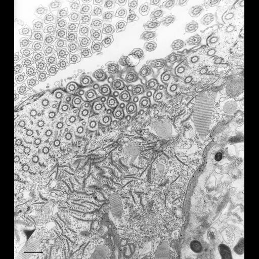  NCBI Organism:Paramecium caudatum; Cell Types:cell by organism, eukaryotic cell, , ; Cell Components:oral apparatus Biological process:oral apparatus organization