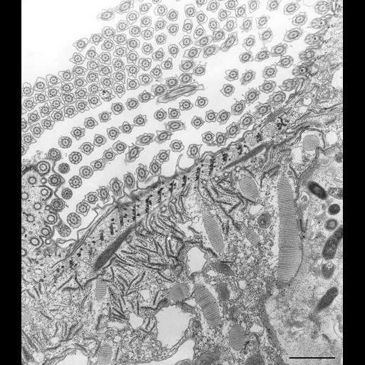  NCBI Organism:Paramecium caudatum; Cell Types:cell by organism, eukaryotic cell, , ; Cell Components:oral apparatus Biological process:phagocytosis, digestion;