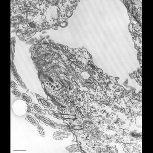  NCBI Organism:Paramecium caudatum; Cell Types:cell by organism, eukaryotic cell, , ; Cell Components:oral apparatus, vesicle membrane, microtubule associated complex, early phagosome; Biological process:oral apparatus organization, digestive system process;