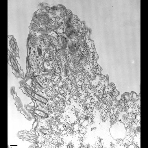  NCBI Organism:Paramecium caudatum; Cell Types:cell by organism, eukaryotic cell, , ; Cell Components:pre-autophagosomal structure Biological process:phagocytosis