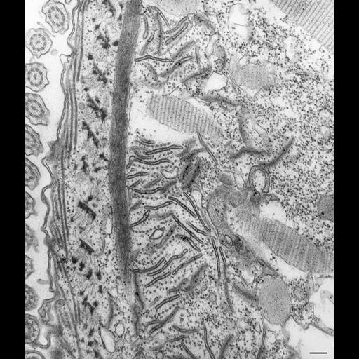  NCBI Organism:Paramecium caudatum; Cell Types:cell by organism, eukaryotic cell, , ; Cell Components:oral apparatus, microtubule associated complex; Biological process:oral apparatus organization, phagocytosis;