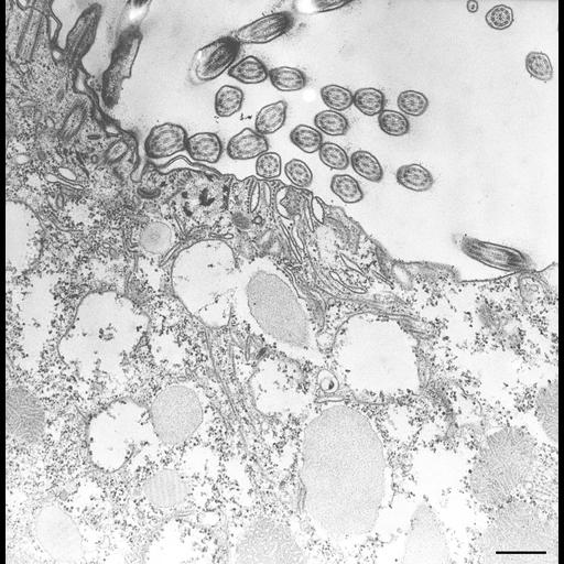  NCBI Organism:Paramecium caudatum; Cell Types:cell by organism, eukaryotic cell, , ; Cell Components:oral apparatus, coated pit, vesicle membrane; Biological process:digestion, digestive system process;