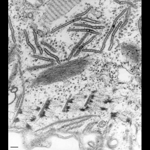  NCBI Organism:Paramecium caudatum; Cell Types:cell by organism, eukaryotic cell, , ; Cell Components:oral apparatus Biological process:oral apparatus organization