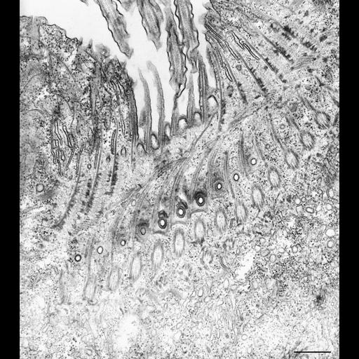  NCBI Organism:Paramecium caudatum; Cell Types:cell by organism, eukaryotic cell, , ; Cell Components:oral apparatus Biological process:oral apparatus organization