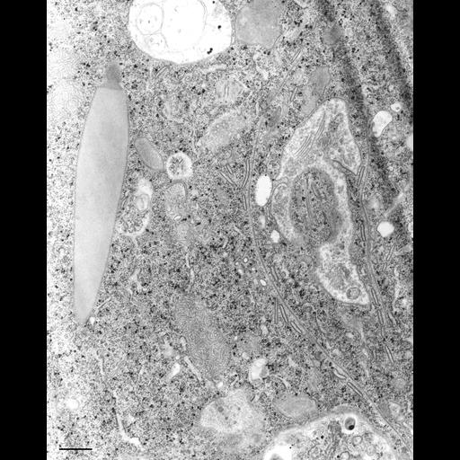  NCBI Organism:Paramecium caudatum; Cell Types:cell by organism, eukaryotic cell, , ; Cell Components:endosome, microtubule associated complex; Biological process:oral apparatus organization, microtubule-based process;