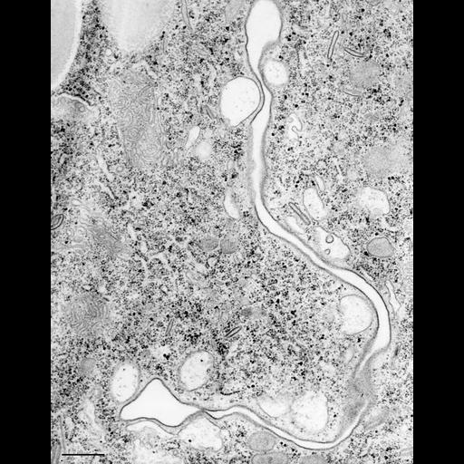  NCBI Organism:Paramecium caudatum; Cell Types:cell by organism, eukaryotic cell, , ; Cell Components:oral apparatus, vacuolar proton-transporting V-type ATPase, V0 domain, ; Biological process:phagocytosis, digestive system process, digestion;