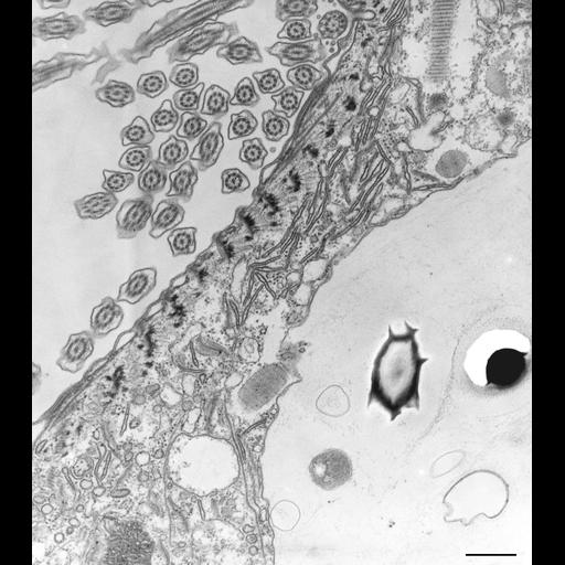  NCBI Organism:Paramecium caudatum; Cell Types:cell by organism, eukaryotic cell, , ; Cell Components:vesicle membrane, endosome; Biological process:phagocytosis