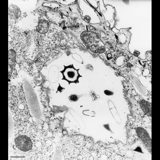  NCBI Organism:Paramecium caudatum; Cell Types:cell by organism, eukaryotic cell, , ; Cell Components:cytoproct, microtubule associated complex, vesicle membrane; Biological process:digestive system process, cortical cytoskeleton organization;