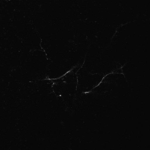  NCBI Organism:Xenopus laevis; Cell Types:CNS neuron (sensu Vertebrata) Cell Components:dendrite, cytoplasm, axon, neuronal cell body; Biological process:neuron development, morphogenesis of a branching structure;
