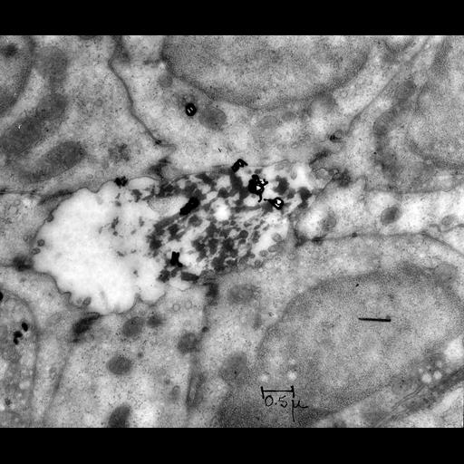  NCBI Organism:Cavia porcellus; Biological process:protein secretion, protein transport;