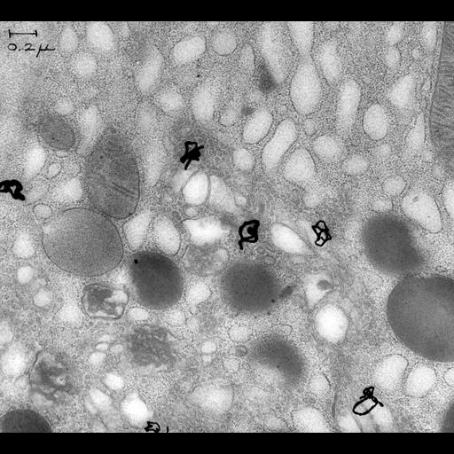  NCBI Organism:Cavia porcellus; Cell Types:exocrine cell Cell Components:rough endoplasmic reticulum, Golgi-associated vesicle; Biological process:protein secretion, protein transport;