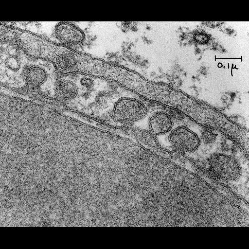  NCBI Organism:Mus musculus; Cell Types:endothelial cell Cell Components:caveola Biological process:regulation of vascular permeability