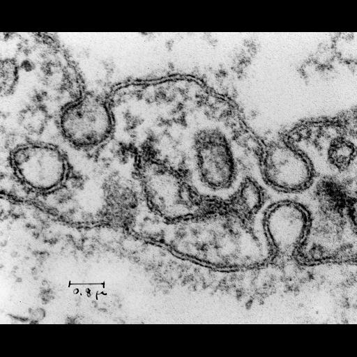  NCBI Organism:Rattus; Cell Types:capillary endothelial cell Cell Components:caveola, vesicle; Biological process:regulation of vascular permeability