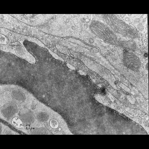  NCBI Organism:Mus musculus; Cell Types:capillary endothelial cell, fenestrated cell; Biological process:regulation of vascular permeability