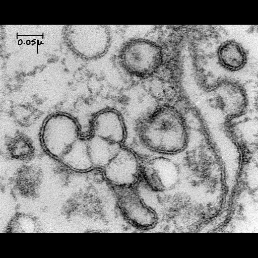  NCBI Organism:Rattus; Cell Types:endothelial cell Cell Components:caveola, vesicle; Biological process:regulation of vascular permeability