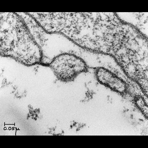  NCBI Organism:Rattus; Cell Types:capillary endothelial cell Biological process:regulation of vascular permeability