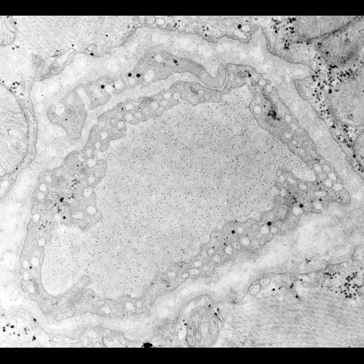  NCBI Organism:Rattus; Cell Types:capillary endothelial cell Cell Components:vesicle Biological process:regulation of vascular permeability