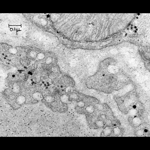  NCBI Organism:Rattus; Cell Types:capillary endothelial cell Cell Components:vesicle Biological process:regulation of vascular permeability