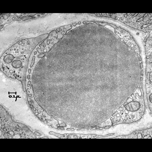  NCBI Organism:Coloceras guinea; Cell Types:blood cell, capillary endothelial cell, pericyte cell; Biological process:regulation of vascular permeability