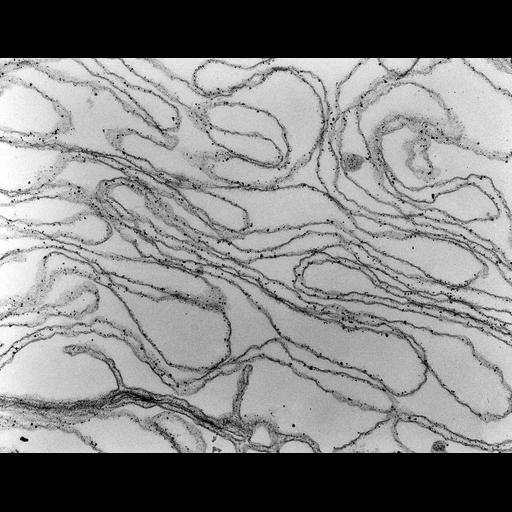  Cell Types:blood cell, ; Cell Components:plasma membrane, spectrin;