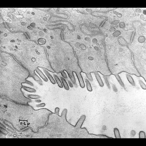  NCBI Organism:Rattus rattus; Cell Types:epithelial cell Cell Components:microvillus Biological process:intestinal absorption