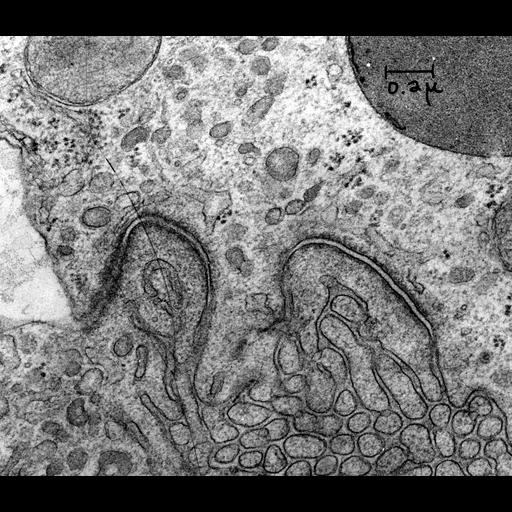  NCBI Organism:Rattus; Cell Types:kidney tubule cell Cell Components:adherens junction, desmosome; Biological process:adherens junction organization