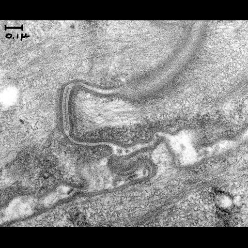  NCBI Organism:Anura; Cell Components:desmosome Biological process:desmosome assembly, plasma membrane organization;