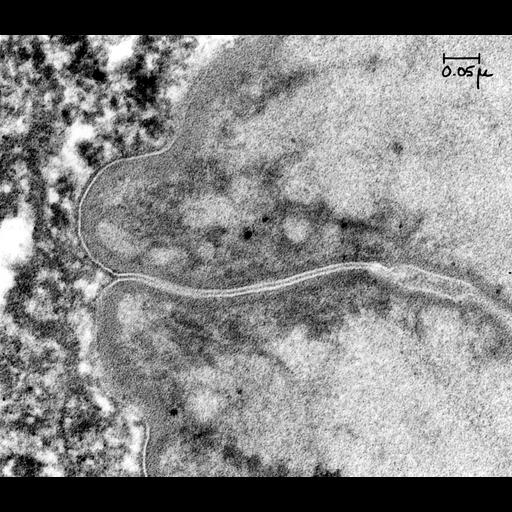  NCBI Organism:Bufo marinus; Cell Types:epithelial cell Cell Components:tight junction, plasma membrane part; Biological process:tight junction assembly