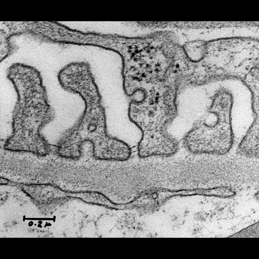  NCBI Organism:Rattus; Cell Types:glomerular endothelial cell, , kidney cell; Biological process:glomerular filtration