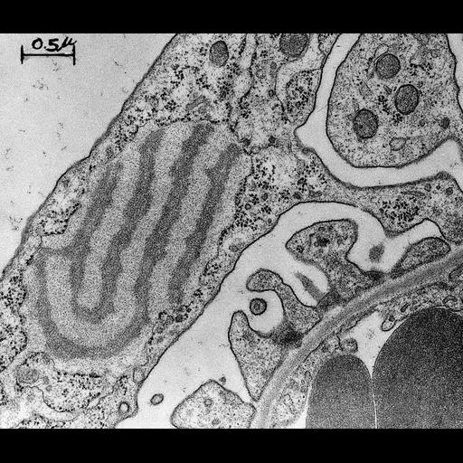  NCBI Organism:Rattus; Cell Types:kidney cell, glomerular endothelial cell, ; Cell Components:basement membrane Biological process:glomerular filtration