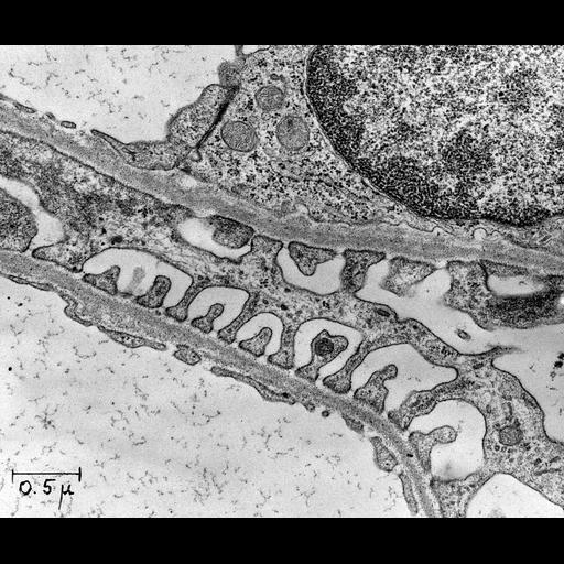  NCBI Organism:Rattus; Cell Types:kidney cell, glomerular capillary endothelial cell, ; Cell Components:basement membrane Biological process:glomerular filtration