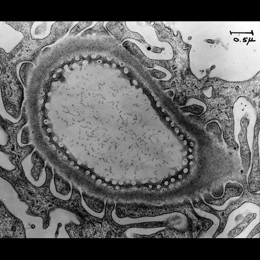  NCBI Organism:Rattus; Cell Types:kidney cell, fenestrated cell, glomerular endothelial cell; Cell Components:basement membrane Biological process:glomerular filtration