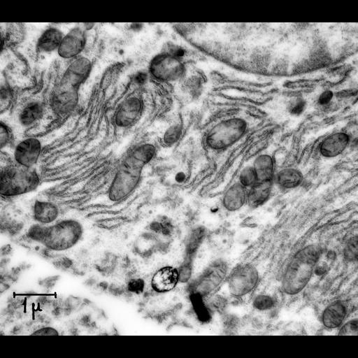  NCBI Organism:Rattus; Cell Types:hepatocyte Cell Components:rough endoplasmic reticulum, mitochondrion, nucleus; Biological process:organelle organization