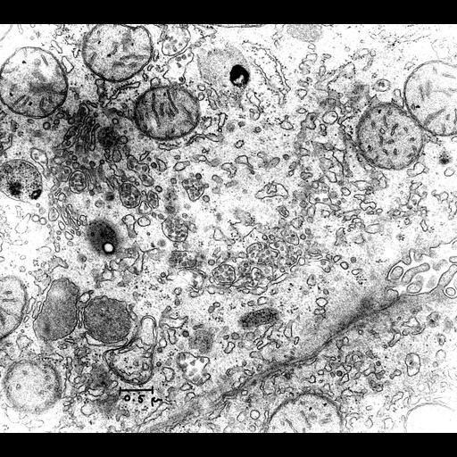  NCBI Organism:Rattus; Cell Types:hepatocyte Cell Components:Golgi apparatus, mitochondrion, cell-cell junction, low-density lipoprotein particle, smooth endoplasmic reticulum;