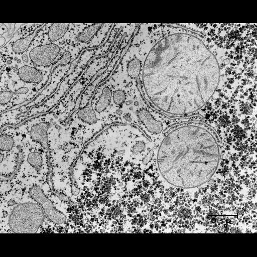  NCBI Organism:Rattus; Cell Types:hepatocyte Cell Components:rough endoplasmic reticulum, mitochondrion, glycogen granule; Biological process:organelle organization