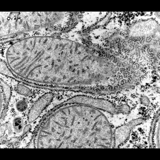  NCBI Organism:Rattus; Cell Types:hepatocyte Cell Components:mitochondrion, glycogen granule; Biological process:organelle organization