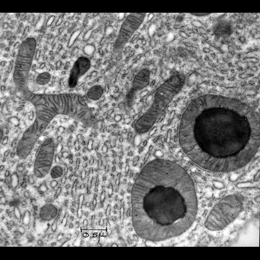  NCBI Organism:Cavia porcellus; Cell Components:mitochondrion, mitochondrial crista, lipid particle;