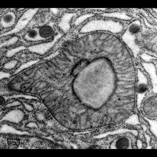  NCBI Organism:Cavia porcellus; Cell Components:mitochondrion, mitochondrial crista, mitochondrial membrane, lipid particle;