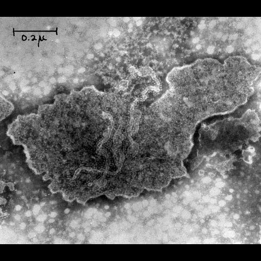  NCBI Organism:Neurospora; Cell Components:mitochondrion