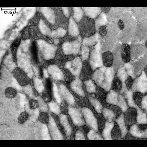  NCBI Organism:Rattus; Cell Types:cardiac muscle cell Cell Components:mitochondrion, myofibril; Biological process:regulation of cardiac muscle contraction