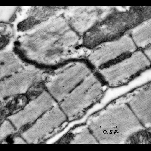  NCBI Organism:Rattus; Cell Types:cardiac muscle cell Cell Components:intercalated disc, mitochondrion, myofibril; Biological process:regulation of cardiac muscle contraction