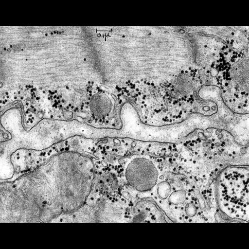  NCBI Organism:Rattus; Cell Types:cardiac muscle cell Cell Components:, mitochondrion, glycogen granule, myofibril; Biological process:regulation of cardiac muscle contraction