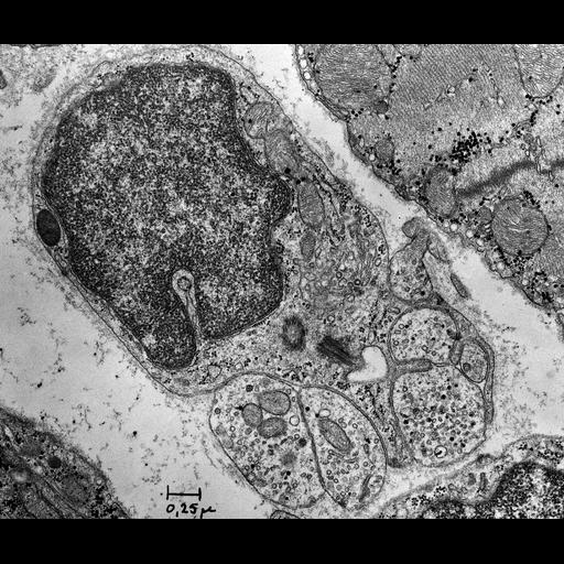  NCBI Organism:Rattus; Cell Types:non-myelinating Schwann cell, ; Cell Components:nucleus, mitochondrion, synaptic vesicle;